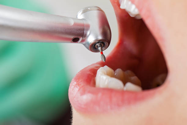 Best Emergency Tooth Extraction in Rosamond, CA